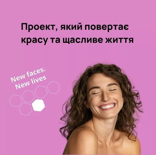 Благодійний Фонд "Мрію Жити" Допомога Дітям з ДЦП